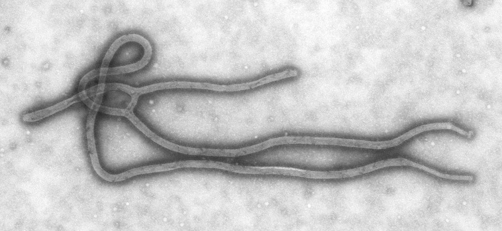 Epidemia di Ebola